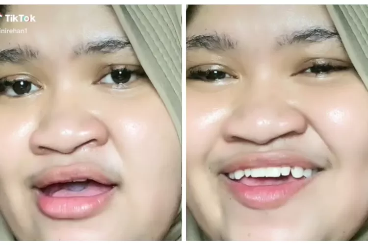 Viral Di Tiktok Lagu ‘begitu Sulit Lupakan Rehan Ini Loh Lagu Asli Beserta Liriknya Suara 9728