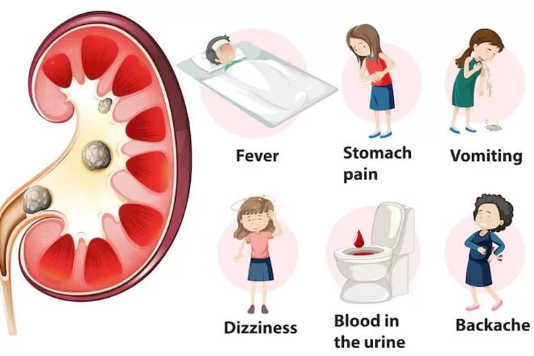 Ilustrasi. Tanda-tanda penyakit ginjal misterius (freepik)