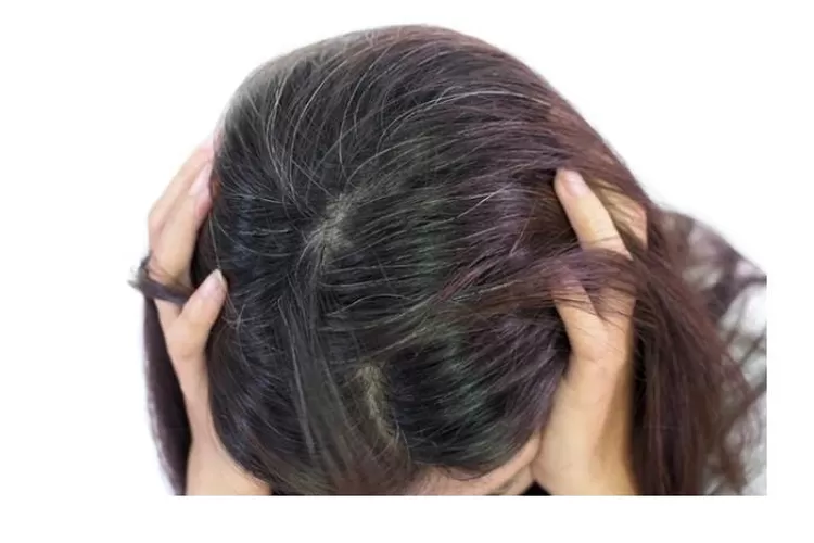 Uban tumbuh tak mengenal usia 