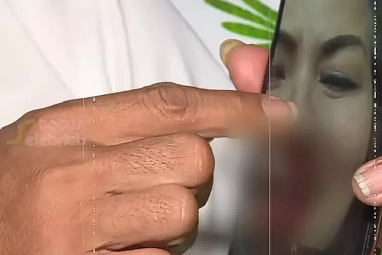 Foto Wajah Venna Melinda Penuh Darah, Ahli Malah Ragukan Sumbernya Karena Bogem Ferry Irawan (Tangkap Layar Youtube Status Selebrities)