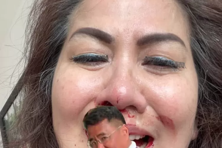 Venna  Melinda menunjuk Hotman Paris sebagai pengacara dugaan kasus KDRT nya. Ferry Irawan ternyata menunjuk Hotma Sitompul yang juga pengacara kondang