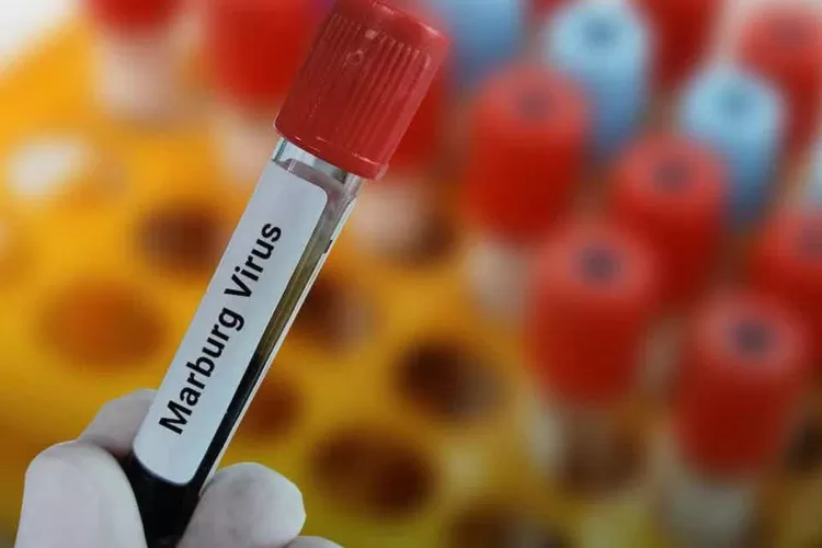 virus Marburg  (theconversation.com)