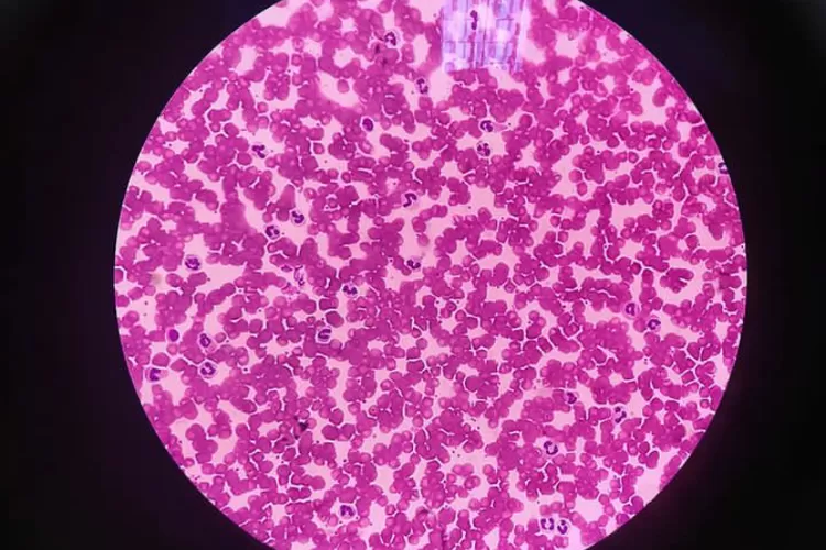 studi terbaru menyebutkan bahwa sel darah putih berperan untuk membersihkan sel hati yang sudah mati (Instagram @baiqsitirahmayasni)