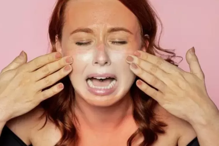 Waspada! Hindari 3 Mitos Merawat Luka Bakar Berikut ini, Nomor 2 Sering Dilakukan (Foto: Female Daily)