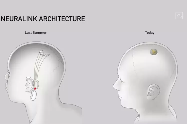 Perusahaan milik Elon Musk dapatkan izin uji coba tanam chip ke otak manusia