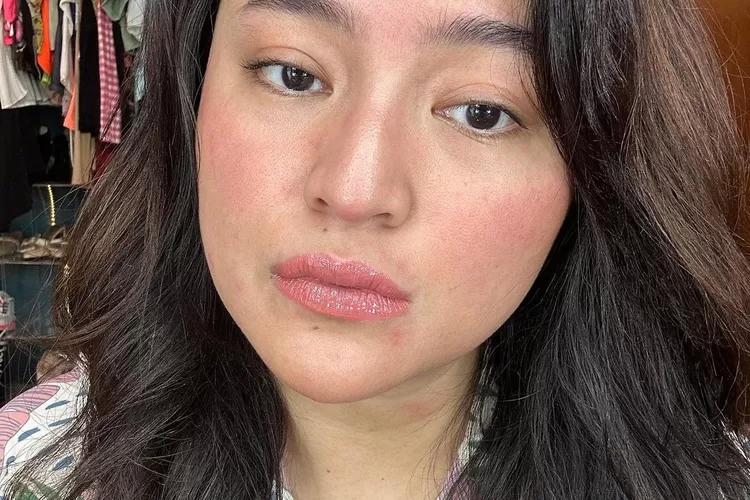 Marshanda mengunggah foto dirinya dengan wajah merah dan bruntusan hingga akhirnya mengundang reaksi netizen (Instagram @marshanda99)