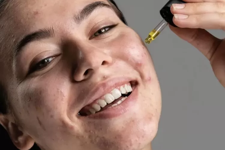 Wajib Coba! Berikut 3 Rekomendasi Skincare untuk Kulit Sensitif yang Patut Menjadi Andalan (Foto: Female Daily)