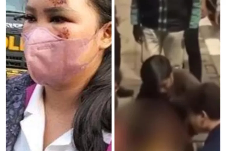 Kolase. Korban tabrak oleh pacarnya sendiri (Sytha AR)