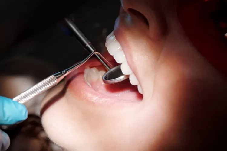 Pemeriksaan gigi (Pexels/Cedric Fauntleroy)