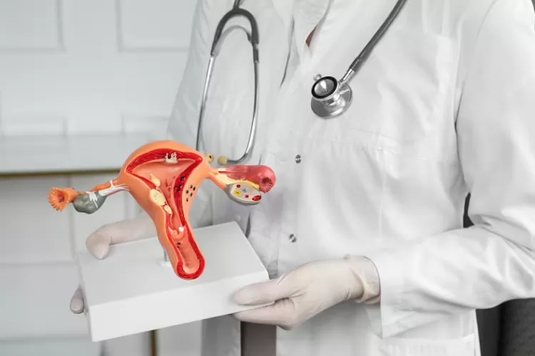 Cara membedakan kista ovarium ganas dan jinak di rahim (Freepik)