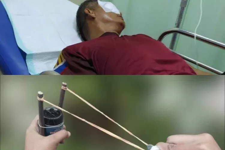 Guru SMA Bengkulu alami kekerasan dengan ketapel hingga bola mata harus dikeluarkan, usai tegur murid yang merokok.  (YouTube Gini Gitu Channel.)