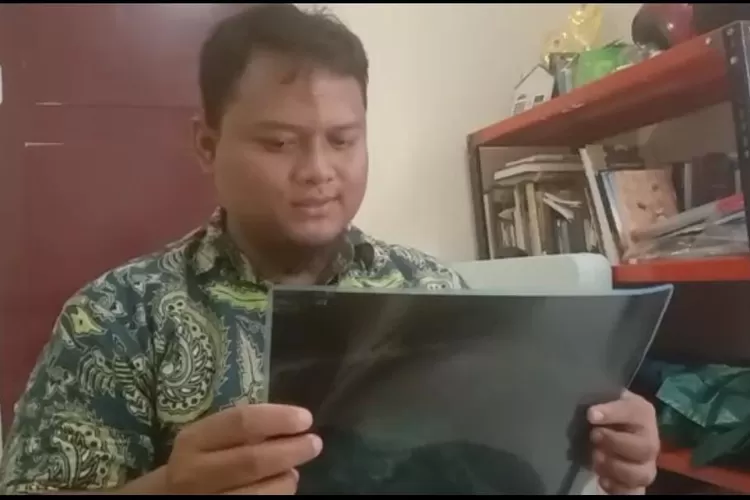 Orangtua korban chiki ngebul di Pondokgede, Kota Bekasi melihat hasil rontgen anaknya. Foto Pay/Radarbekasi.id