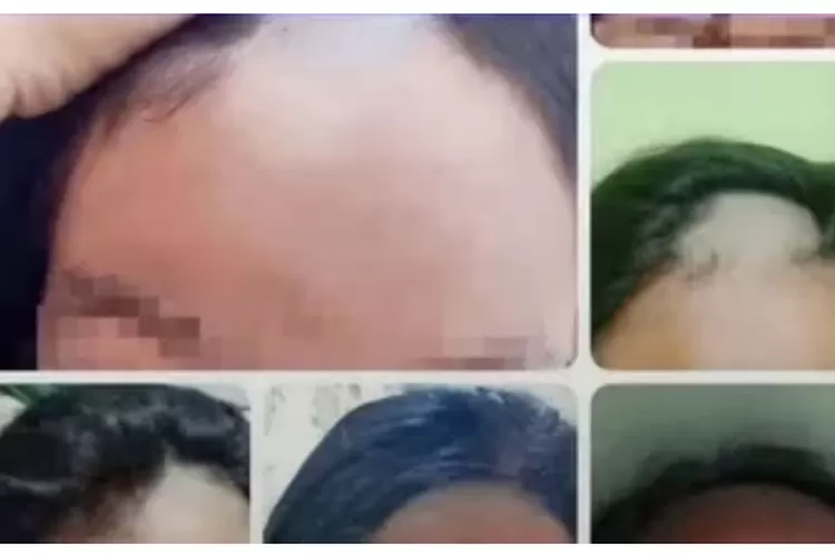 Seorang guru menggunduli belasan siswa SMPN 1 Sukodadi, lantaran tak memakai ciput atau dalaman jilbab. (Dok Istimewa )