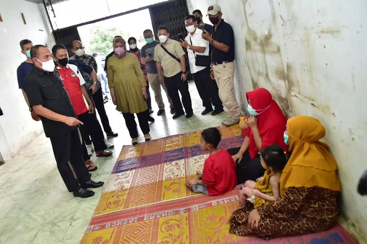 Gubernur Sumatera Utara (Sumut) Edy Rahmayadi bersama Ketua TP PKK Sumut Nawal Lubis menjenguk dua anak penderita penyakit kulit asal Kabupaten Mandailing Natal, Haikal (9) dan Zakira (3), di Jalan Karya Jaya Medan Johor, Minggu (4/7/2021).