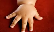 Heboh Bayi Alami Obesitas, Kenali Penyebab dan Cara Mencegahnya