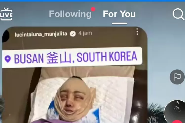 Foto Lucinta Luna Sedang Operasi (Tangkapan Layar TikTok /@lucintaluna_manjalita)