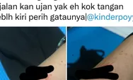 Jogja Darurat Klitih, Tangan Wanita Ini Luka Robek Usai Dipepet 2 Pengendara Motor