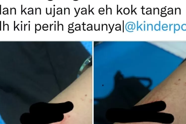 Jogja Darurat Klitih, Tangan Wanita Ini Luka Robek Usai Dipepet 2 Pengendara Motor (Twitter)