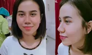Dipuji netizen tampilan Mayang terbaru usai melakukan operasi hidung: cantik gak keliatan oplas hidungnya