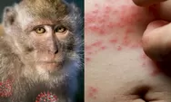 Wabah Cacar Monyet Masuk Darurat Global Setelah Menyebar di 70 Negara
