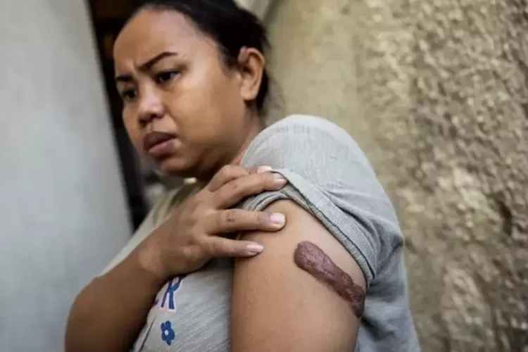 Kartika Puspitasari yang memenangkan kasus penyiksaan terhadap dirinya oleh majikannya di hong Kong mendapat kompensasi Rp 1,6 miliar.