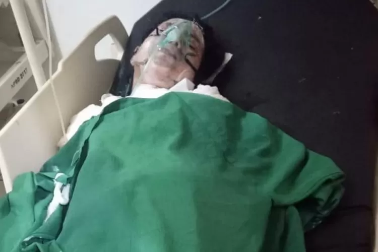 Diduga, Oknum Polisi Bakar Hidup-hidup Kekasihnya (dok. Ist)