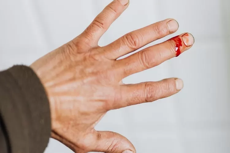 Ilustrasi Kumpulan cerita lucu dan kisah nyata, rujak sebungkus harga tiga ribu dan penjual ikan disapit kepiting (pexels/karolina grabowska)