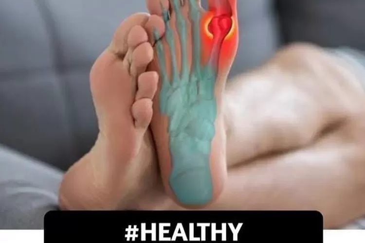 Asam urat ditandai terasa nyeri. Mari kenali gejala dan penyebabnya. (instagram @catatan.sidokter )