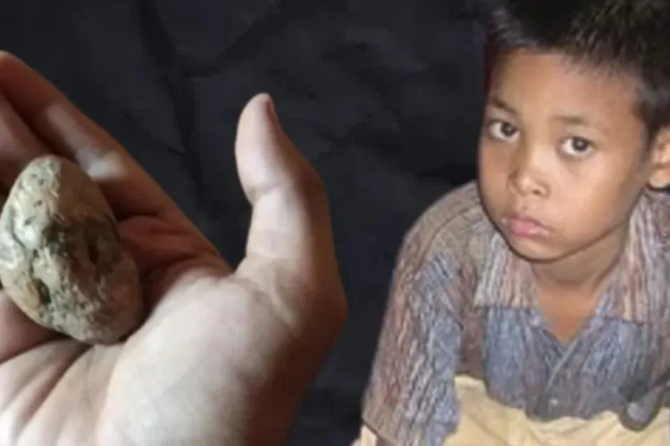 Dukun cilik Ponari yang sempat viral bisa mengobati secara nonmedis seperti Ida Dayak 